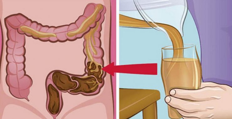 detoxifiați vă colonul în mod natural