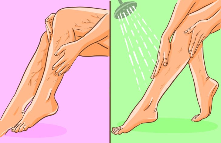 exerciii medicale pentru picior varicoza